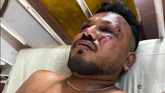 https://www.hindustantimes.com/india-news/40yearold-man-in-ahmedabad-hospital-says-he-survived-air-india-crash-101749734358509.html